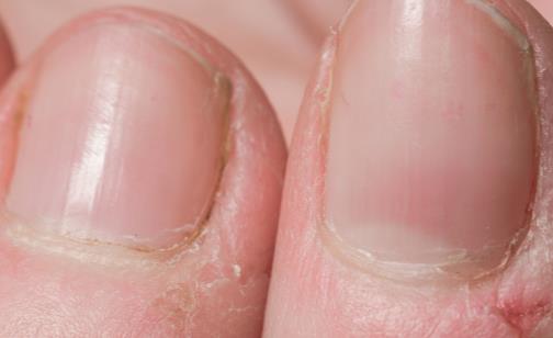 健康狀況跟手指月牙有關嗎 月牙多少和體質強弱關系