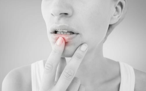 嘴唇干燥脫皮怎么辦 推薦幾個護(hù)理方法