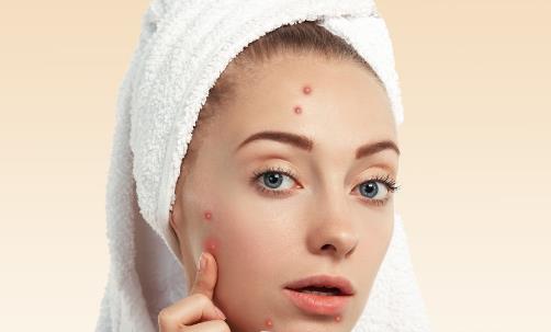 皮膚油怎么辦 5個(gè)方法幫你正確控油