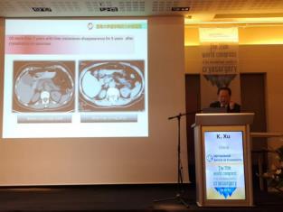 濟(jì)南腫瘤醫(yī)院選擇廣州復(fù)大腫瘤醫(yī)院:冷凍需要新理念