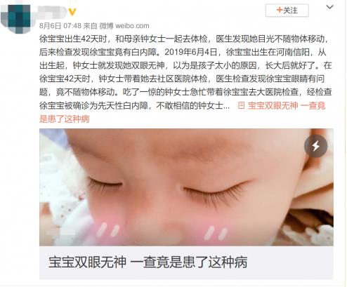 比兒童近視可怕一萬倍,剛出生的寶寶視力危機你了解嗎?