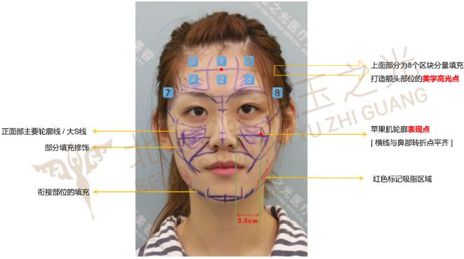 自體多肽脂肪實現新突破，塑造無法復制的自然美