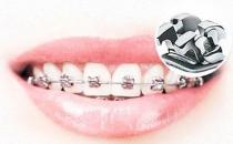 武漢德韓口腔真相大揭秘，金屬矯正的過程會不會很疼？