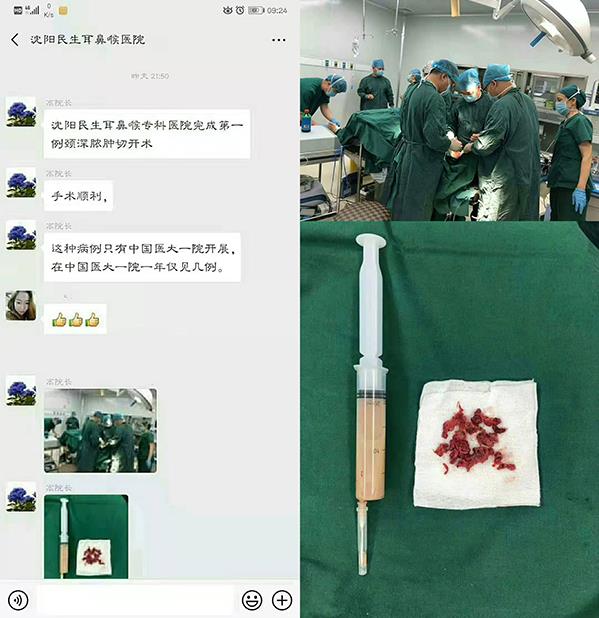 沈陽民生耳鼻喉醫院看耳鼻喉口碑如何呢 誠信行醫真心惠民