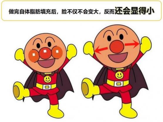 韋元強講解：瘦子也適合做自體脂肪填充嗎？