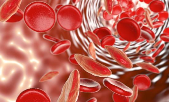 大棗紅糖鐵鍋炒菜能不能補鐵 缺鐵性貧血的正確食補法則