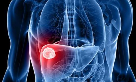 男性最需要去做的就是養(yǎng)肝 選對(duì)正確的具有護(hù)肝功效的食物