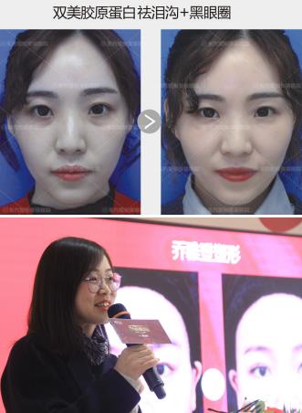 鄭州東方整形醫院喬妹VIP私享會圓滿成功