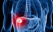 ?男性最需要去做的就是養(yǎng)肝 選對(duì)正確的具有護(hù)肝功效的食物