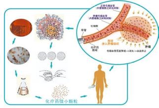 廣州復大腫瘤醫院牛立志教授:癌癥治療技術——血管介入療法