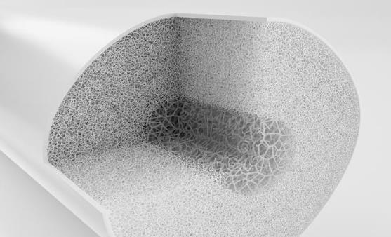 骨質(zhì)疏松的認(rèn)知誤區(qū)你中了沒 骨質(zhì)疏松的飲食保健