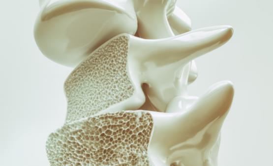 骨質(zhì)疏松的認(rèn)知誤區(qū)你中了沒 骨質(zhì)疏松的飲食保健