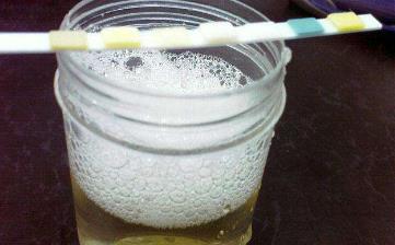 【尿泡沫】尿泡沫多是怎么回事_尿泡沫多散不干凈的原因_尿泡沫到尿毒癥 【尿泡沫】尿泡沫多是怎么回事_尿泡沫多散不干凈的原因_尿泡沫到尿毒癥