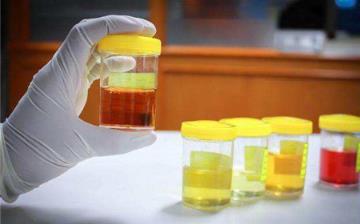 【尿液黃】尿液黃是什么原因_尿液發(fā)黃而渾濁是怎么回事_長期尿黃是什么病 【尿液黃】尿液黃是什么原因_尿液發(fā)黃而渾濁是怎么回事_長期尿黃是什么病