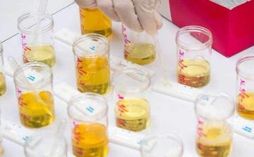 【尿液發黃】尿液發黃有異味是怎么回事_尿液發黃泡沫多_尿液特別黃的原因 【尿液發黃】尿液發黃有異味是怎么回事_尿液發黃泡沫多_尿液特別黃的原因