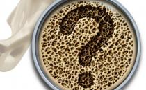 ?骨質疏松的常見認知誤區 看看你有沒有中招