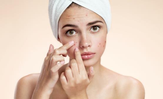 想祛痘就吃六種常見食物 防痘攻擊的關(guān)鍵是排毒