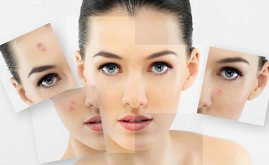 祛痘印小竅門學起來 讓女性顏值隨時在線