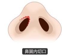 北京圣慈整形醫院鼻子王王軍怎么樣?專業實力 讓你放心美