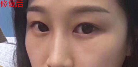 衛(wèi)婭日記：我一直都以為眼袋對我的影響只是美觀，直到我了解了以后……