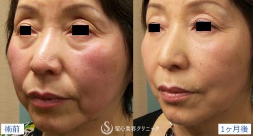 圣心醫療美容鐮倉達郎總院長,帶你探索年輕的秘密