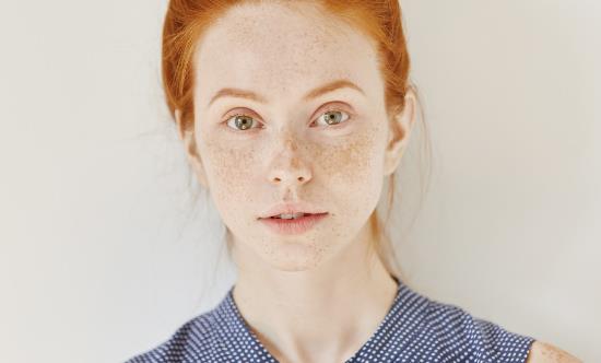 激光祛斑會(huì)不會(huì)反彈 適合激光祛斑的人群