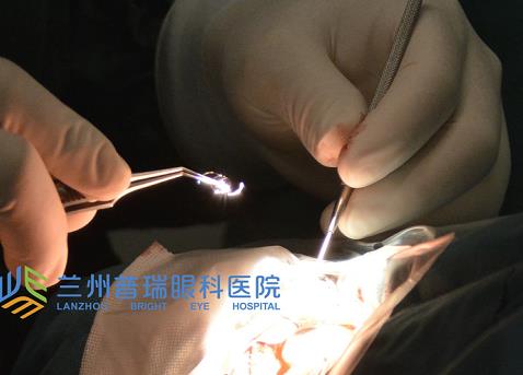 蘭州普瑞眼科治療白內障怎么樣？預防白內障從年輕開始