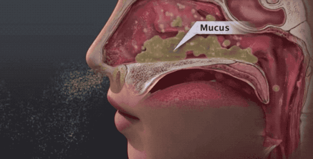 春季鼻敏感，兒科專家鮑秀蘭給大家支招！