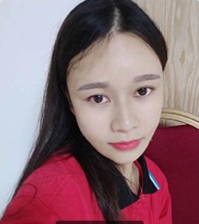 幻柔筆記:眼袋修復后氣質立現,怎么看都是青春靚麗!