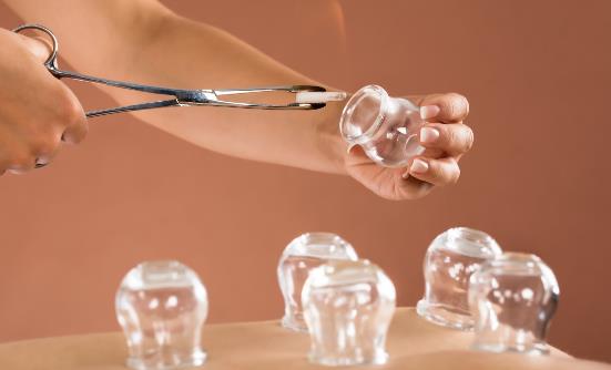 拔火罐減肥能減肥嗎 拔火罐減肥有哪些注意事項(xiàng)