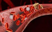 ?能軟化血管的12種食物 讓血管恢復(fù)正常