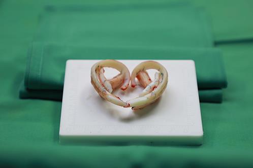 為愛圓夢給耳朵一次新生——記一場特殊的直播