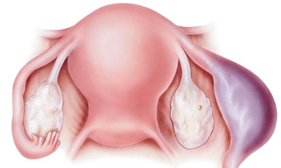 什么原因會引起宮外孕 這6個問題教你預防宮外孕