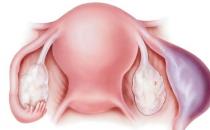 ?什么原因會引起宮外孕 這6個問題教你預防宮外孕