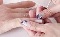 ?甲溝炎竟是自己作出來的 甲溝炎預防成了關鍵