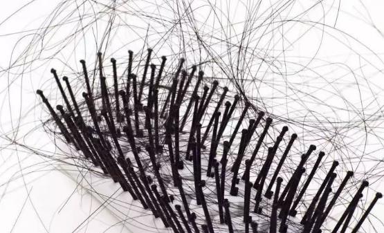 女性白領改善脫發問題 推薦10款食譜防脫發