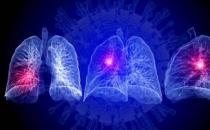 國產AI助力全球抗疫|FDA許可科亞醫療「智能分診系統」疫情臨床應用和銷售