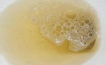 肚臍下面疼是怎么回事，肚臍下面疼是怎么回事男性